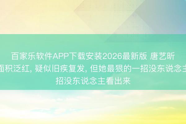 百家乐软件APP下载安装2026最新版 唐艺昕胸口大面积泛红， 疑似旧疾复发， 但她最狠的一招没东说念主看出来